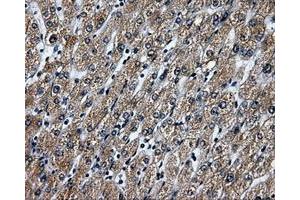 Immunohistochemical staining of paraffin-embedded liver tissue using anti-RALBP1mouse monoclonal antibody. (RALBP1 antibody)