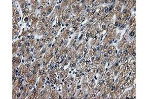 Immunohistochemical staining of paraffin-embedded liver tissue using anti-RALBP1mouse monoclonal antibody. (RALBP1 antibody)