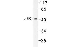 Image no. 1 for anti-Interleukin 7 Receptor (IL7R) antibody (ABIN317658) (IL7R antibody)