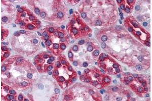 Human Kidney: Formalin-Fixed, Paraffin-Embedded (FFPE) (Calnexin antibody  (AA 204-218))