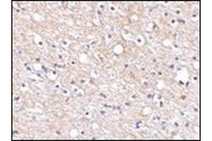 Immunohistochemical staining of human brain tissue using AP30680PU-N at 2. (PLXDC2 antibody  (N-Term))