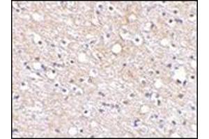 Immunohistochemical staining of human brain tissue using AP30680PU-N at 2.