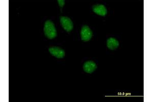 Immunofluorescence of purified MaxPab antibody to GATAD2B on HeLa cell.