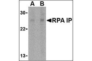 Western blot analysis of RPA Interacting Protein in Jurkat cell lysate with this product at (A) 1 and (B) 2 μg/ml. (RPAIN antibody  (C-Term))