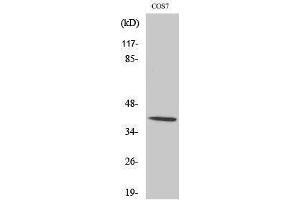 Western Blotting (WB) image for anti-V-Crk Sarcoma Virus CT10 Oncogene Homolog (Avian)-Like (CRKL) (pTyr207) antibody (ABIN3173361) (CrkL antibody  (pTyr207))