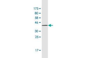 Western Blot detection against Immunogen (42. (Retinol Binding Protein 5 antibody  (AA 1-135))
