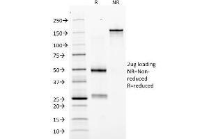 SDS-PAGE (SDS) image for anti-Erythropoietin (EPO) (AA 28-162) antibody (ABIN6939313)