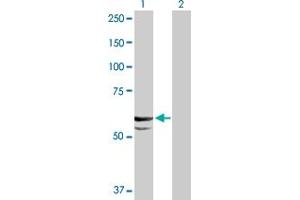 Western Blot analysis of CYP11A1 expression in transfected 293T cell line by CYP11A1 MaxPab polyclonal antibody. (CYP11A1 antibody  (AA 1-521))
