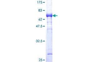 ALDOC Protein (AA 1-364) (GST tag)