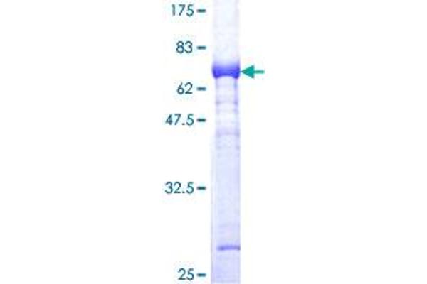 ALDOC Protein (AA 1-364) (GST tag)
