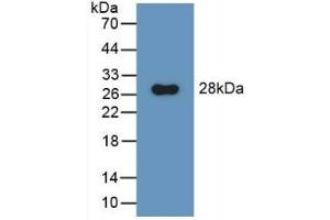 Detection of Recombinant GluAP, Rat using Polyclonal Antibody to Aminopeptidase A (ENPEP) (ENPEP antibody  (AA 409-624))