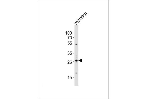 BHLHA9 antibody  (N-Term)