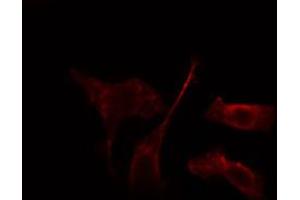 ABIN6274242 staining HepG2 cells by IF/ICC. (ADRBK2 antibody  (Internal Region))