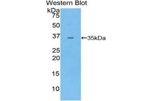 Western blot analysis of the recombinant protein. (PDK4 antibody  (AA 117-387))