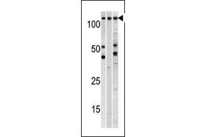 Western blot analysis of anti-CSE1L Pab (ABIN1882070 and ABIN2838356) in, from left to right, , CEM, and mouse heart cell line lysates (35 μg/lane).