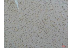 Immunohistochemistry (IHC) analysis of paraffin-embedded Mouse Brain Tissue using Cav pan alpha1 Rabbit Polyclonal Antibody diluted at 1:200. (Cav Pan Alpha1 (pan) antibody)