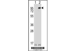 Western blot analysis of WHSC1L1 using rabbit polyclonal WHSC1L1 Antibody using 293 cell lysates (2 ug/lane) either nontransfected (Lane 1) or transiently transfected (Lane 2) with the WHSC1L1 gene. (WHSC1L1 antibody  (N-Term))