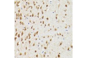 Immunohistochemistry of paraffin-embedded rat brain using PSM Rabbit pAb (ABIN3021834, ABIN3021835, ABIN3021836 and ABIN6216081) at dilution of 1:100 (40x lens). (PSMA3 antibody  (AA 1-255))