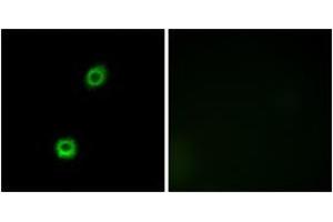 Immunofluorescence (IF) image for anti-Myristoylated Alanine-Rich Protein Kinase C Substrate (MARCKS) (AA 126-175) antibody (ABIN2889023) (MARCKS antibody  (AA 126-175))