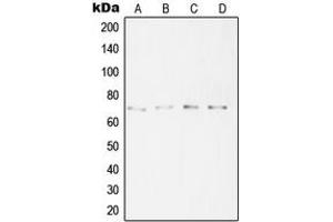 Western blot analysis of SYT16 expression in A431 (A), HeLa (B), A2058 (C), Jurkat (D) whole cell lysates. (SYT16 antibody  (Center))