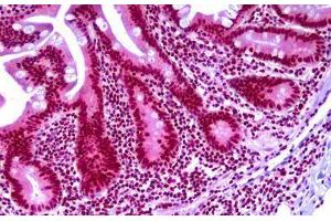 Anti-TARBP2 antibody IHC staining of human small intestine.