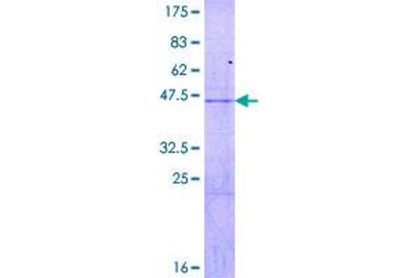 RPL18 Protein (AA 1-188) (GST tag)