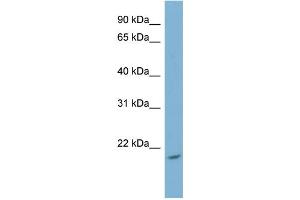 WB Suggested Anti-NME4 Antibody Titration: 0. (NME4 antibody  (Middle Region))