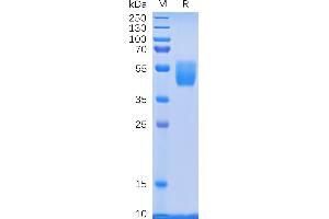 Prostate Stem Cell Antigen (PSCA) (AA 12-86) protein (Fc Tag)