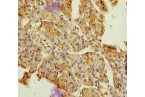 Immunohistochemistry of paraffin-embedded human pancreatic tissue using ABIN7149750 at dilution of 1:100 (Dermatopontin antibody  (AA 19-201))