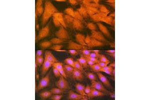 Immunofluorescence analysis of U-2 OS cells using FGF1 Rabbit mAb (ABIN7267182) at dilution of 1:100 (40x lens).