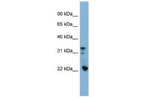 WB Suggested Anti-CRYBB3 Antibody Titration: 0. (CRYBB3 antibody  (Middle Region))