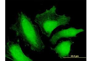 Immunofluorescence of purified MaxPab antibody to MTMR15 on HeLa cell. (FAN1 antibody  (AA 1-533))