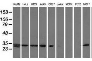 Western blot analysis of extracts (35 µg) from 9 different cell lines by using anti-SPR monoclonal antibody. (SPR antibody)