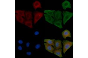ABIN6258559 and ABIN6275575 staining Hela cells by IF/ICC.