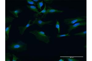 Immunofluorescence of purified MaxPab antibody to UBAC1 on HeLa cell.