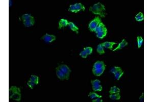 Immunofluorescence staining of PC-3 cells with ABIN7139863 at 1:50, counter-stained with DAPI. (GNG12 antibody  (AA 2-17))
