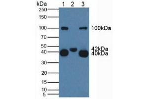 Figure. (CD161 antibody  (AA 73-188))
