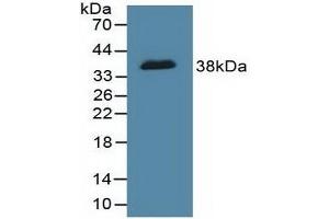 Detection of Recombinant DFFa, Human using Polyclonal Antibody to DNA Fragmentation Factor Subunit Alpha (DFFa) (DFFA antibody  (AA 51-305))