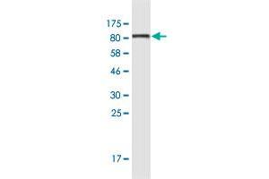 Western Blot detection against Immunogen (87. (Keratin 6B antibody  (AA 1-564))