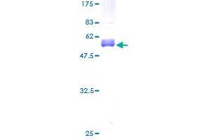 CITED1 Protein (AA 1-193) (GST tag)