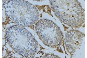 ABIN6274993 at 1/100 staining Mouse testis tissue by IHC-P. (CEP78 antibody  (Internal Region))