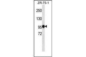 Western blot analysis of PHF14 Antibody (N-term) in ZR-75-1 cell line lysates (35ug/lane). (PHF14 antibody  (N-Term))
