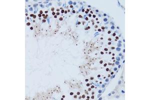 Immunohistochemistry of paraffin-embedded mouse testis using TP53 antibody (ABIN5999084) at dilution of 1/100 (40x lens). (p53 antibody)