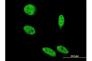 Immunofluorescence of monoclonal antibody to SAP18 on HeLa cell. (SAP18 antibody  (AA 1-153))