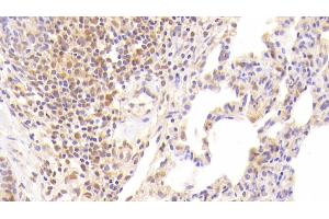 Detection of F2 in Human Lung Tissue using Monoclonal Antibody to Coagulation Factor II (F2) (Prothrombin antibody)