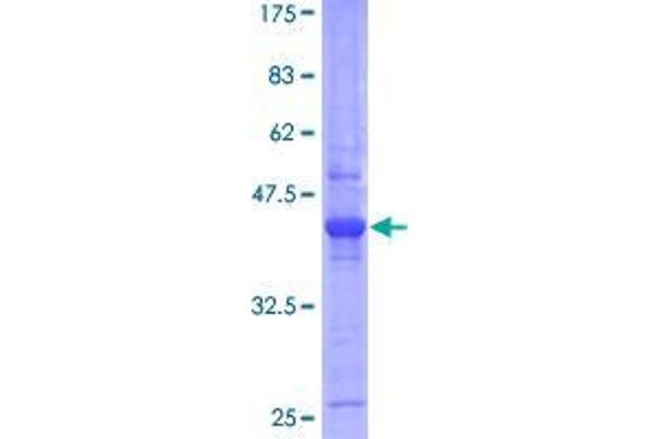 Ethanolamine Kinase 1 Protein (ETNK1) (AA 1-169) (GST tag)