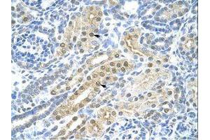 Image no. 1 for anti-Transcription Factor AP-2 gamma (Activating Enhancer Binding Protein 2 Gamma) (TFAP2C) (N-Term) antibody (ABIN203339) (TFAP2C antibody  (N-Term))