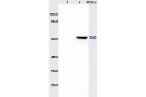 Lane 1: rat liver lysates Lane 2: rat brain lysates probed with Anti CK12/Cytokeratin 12 Polyclonal Antibody, Unconjugated (ABIN872955) at 1:200 in 4 °C.