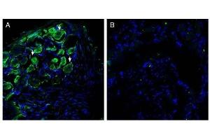 Expression of Piezo2 in rat dorsal root ganglion. (PIEZO2 antibody  (AA 1092-1104))
