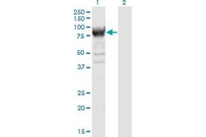 Western Blot analysis of RRM1 expression in transfected 293T cell line by RRM1 monoclonal antibody (M04), clone 1D6. (RRM1 antibody  (AA 593-792))